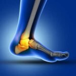 foot joint pain is a cause of gout 